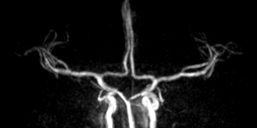 Angio Phase Contrast